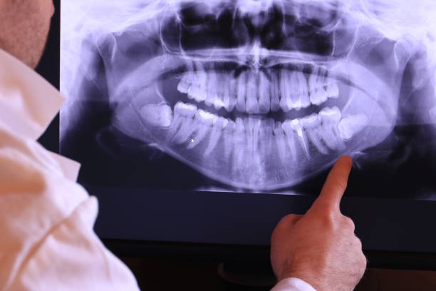 Best Emergency Denture Repair in Worcester, MA